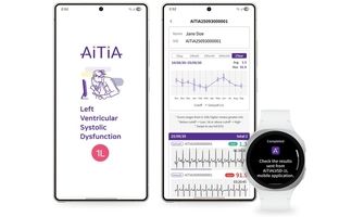 تشخیص زودهنگام نارسایی قلبی و ارتقای سلامت روان با فناوری‌های پوشیدنی سامسونگ